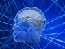 Mũ siêu âm thần kỳ: Công nghệ mới trong việc điều trị bệnh Parkinson?