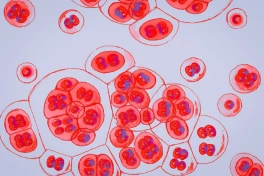 Bí ẩn virus HIV sắp được giải mã nhờ công nghệ nano mRNA?