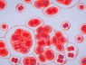 Bí ẩn virus HIV sắp được giải mã nhờ công nghệ nano mRNA?