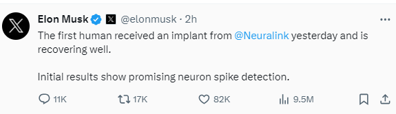 Công ty của Musk đưa thành công thiết bị cấy ghép vào não người