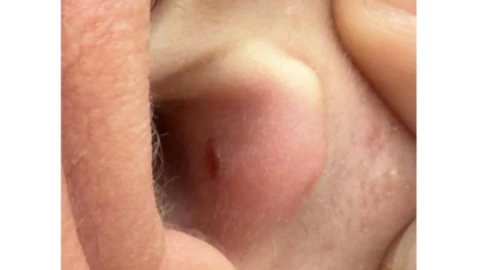 Dòng sản phẩm này của nhà Táo nhận gạch xây nhà khi làm người dùng bị chấn thương