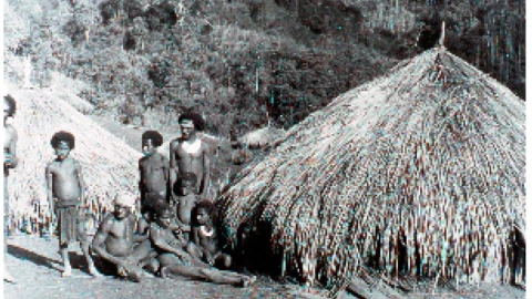 Căn bệnh lý giải tại sao con người không ăn thịt đồng loại