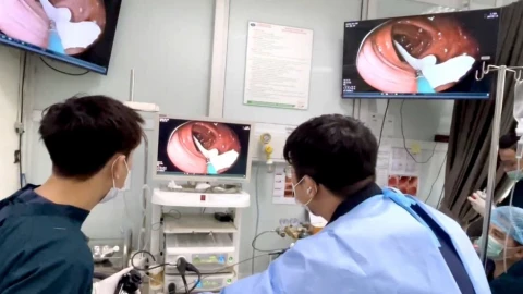 Sán dài 1m bơi tung tăng trong đại tràng bệnh nhân hay ăn đồ tái