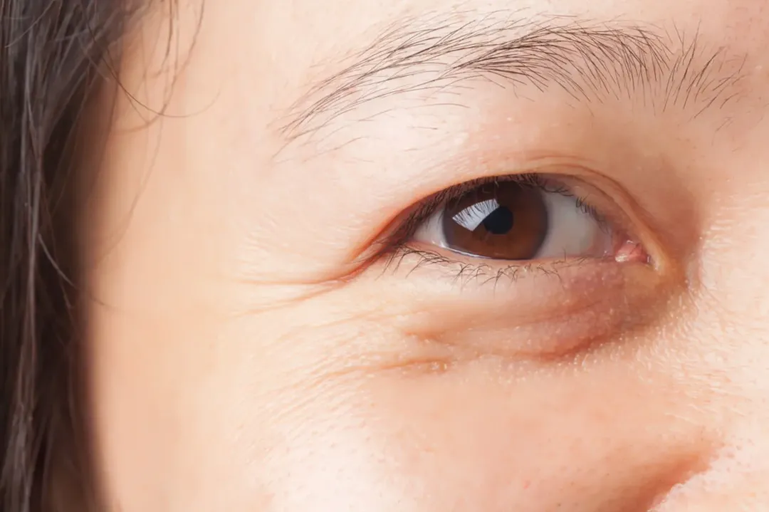 Lợi ích của kem dưỡng da vùng mắt có thể bạn chưa biết 