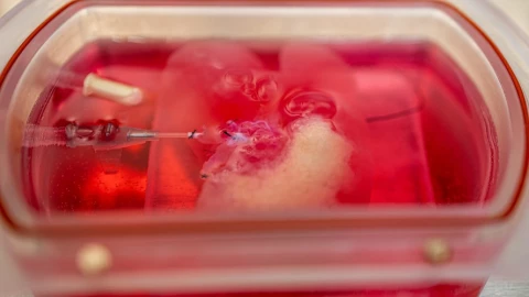 Công nghệ in 3D để tạo ra mô nội tạng, có thể giúp chấm dứt cuộc khủng hoảng thiếu tạng ghép