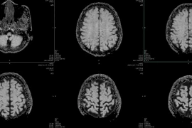 ChatGPT khuyên bệnh nhân cấp cứu ở nhà: AI trong y tế nguy hiểm hơn chúng ta nghĩ