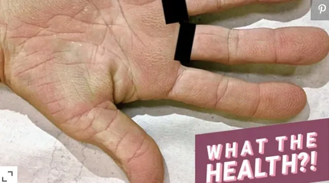 Dừng lướt TikTok và nhìn bàn tay mình: Nếu có dấu hiệu này, nhiều khả năng là ung thư