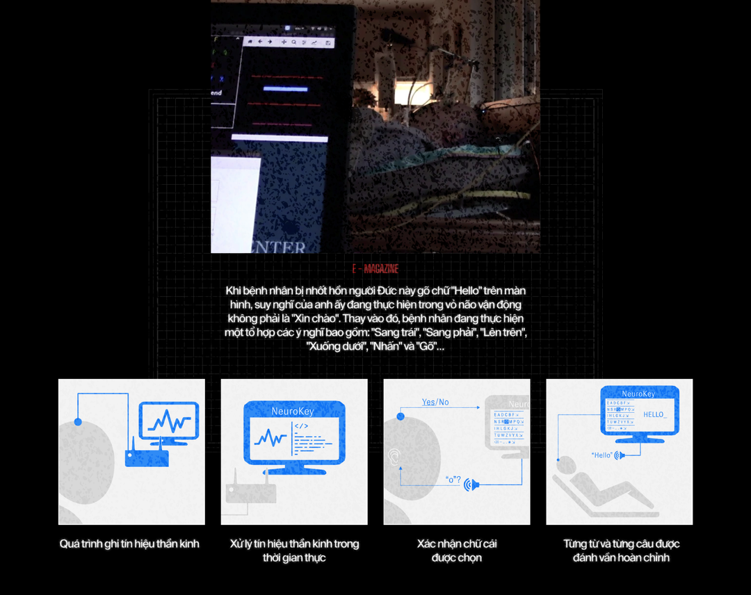 Giải mã cỗ máy kỳ diệu có thể đọc suy nghĩ, giúp bệnh nhân hôn mê cất tiếng nói