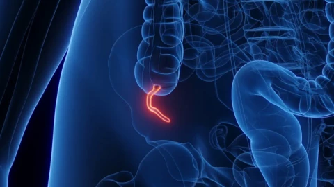 Ruột thừa có chức năng gì? Các nhà sinh vật học giải thích quá trình tiến hóa phức tạp của cơ quan bất tiện này