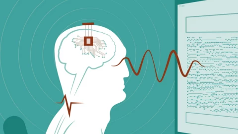 Trung Quốc trở thành quốc gia đầu tiên cấp phép cấy ghép não thương mại