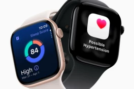 Apple Watch sắp có tính năng huyết áp "đột phá": FDA đang xem xét cho mẫu 2026.