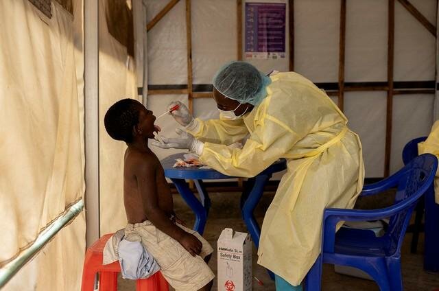 2024-07-24t083712z-837774522-rc2yx8avv8o1-rtrmadp-3-health-mpox-congo-17236923938431151717332_...jpg