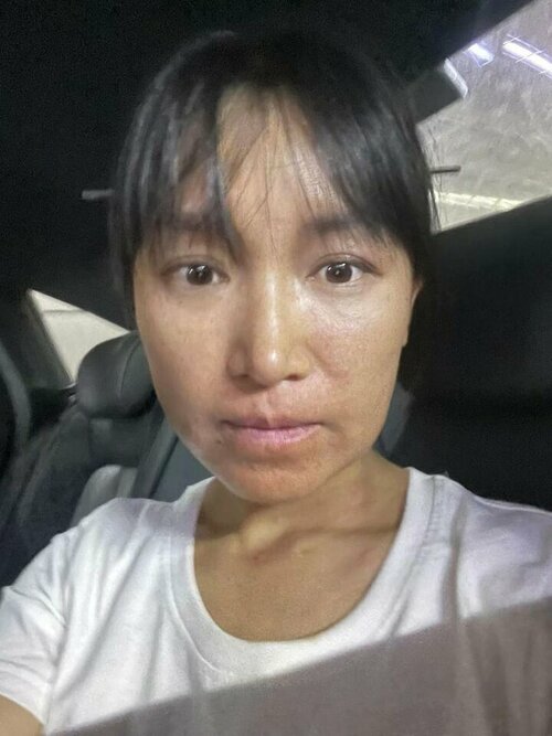 guong-mat-day-mun-cua-ly-tu-that-khi-tai-xuat-khien-nhieu-nguoi-bat-ngodocx-1731729339720.jpeg...jpg