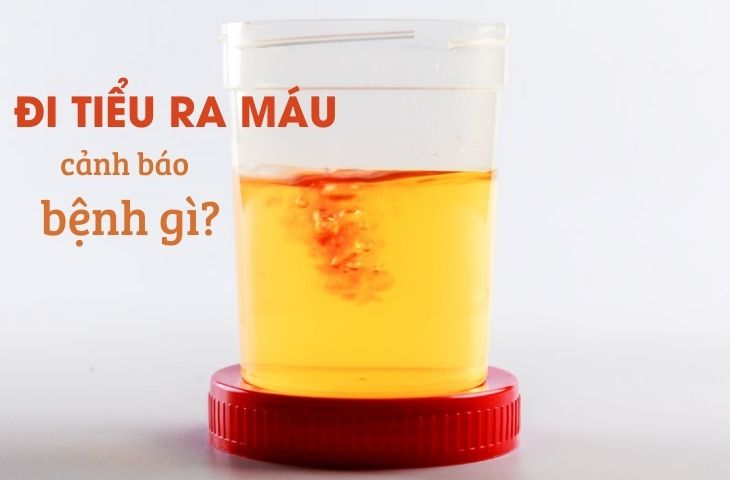 1740468997990.png