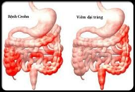 A close-up of the human digestive systemDescription automatically generated