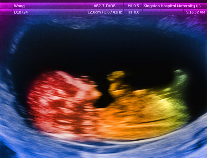 1743574882036.png 1743574882036.png