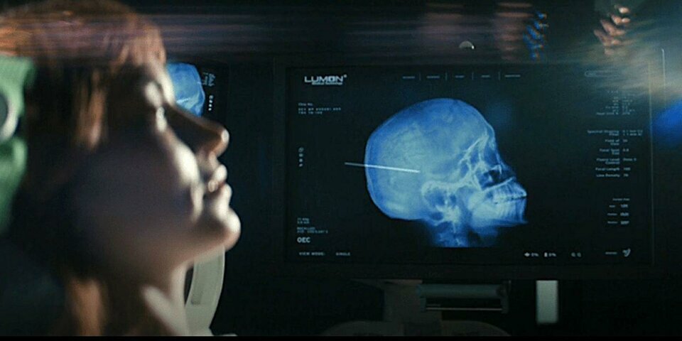 helly-s-severance-surgery-1744086714097971108541-1744110625562-1744110625646763025189_jpg_75.jpg