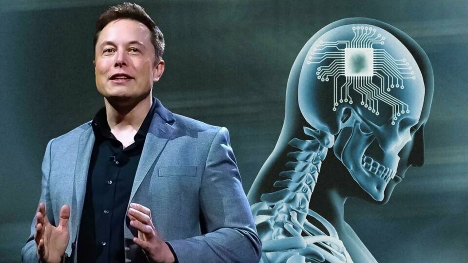 Is-Elon-Musks-Neuralink_jpg_75.jpg Is-Elon-Musks-Neuralink_jpg_75.jpg