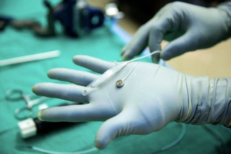 Paradromics-implants-brain-computer-interface-into-first-human-patient_jpg_75.jpg Paradromics-implants-brain-computer-interface-into-first-human-patient_jpg_75.jpg