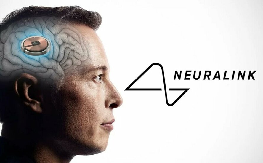 neuralink_jpg_75(1).jpg neuralink_jpg_75(1).jpg